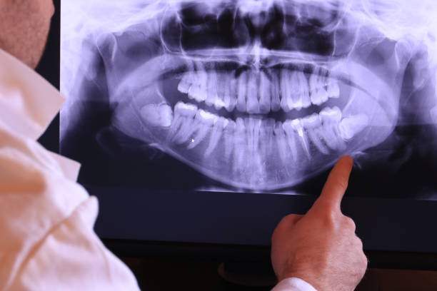 Best Broken or Chipped Tooth Repair in Yakima, WA