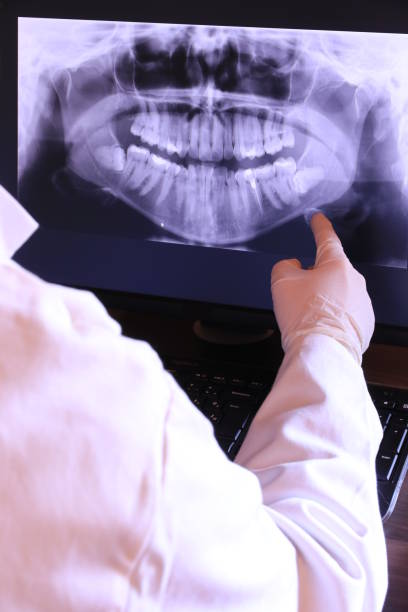 Best Emergency Denture Repair in Yakima, WA