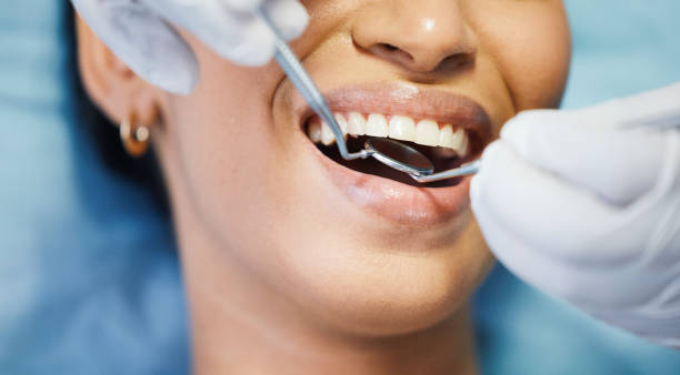 Best Emergency Wisdom Tooth Extraction in Yakima, WA