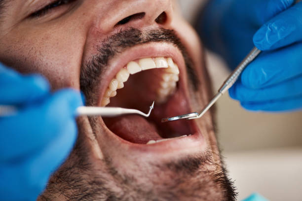 Best Emergency Treatment for Oral Infections in Yakima, WA